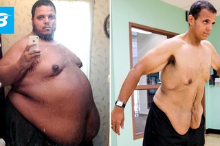 Парень похудел на 150 кг. Это настоящий герой. The Incredible Shrinking Man | Jesse Shand Lost 350 Pounds
