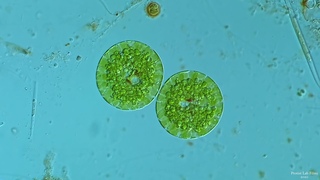 Euglena Encystment - A Rarely Seen Event