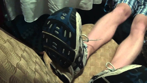 Miracle Leg growth before witnesses Mind Blown Tom