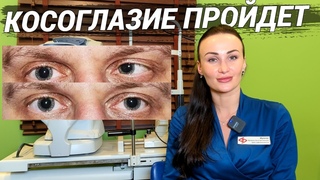 КОСОГЛАЗИЕ: виды, причины, лечение, профилактика! Как видит человек с косоглазием и что делать