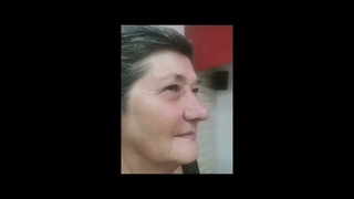 Tratamente faciale Suceava