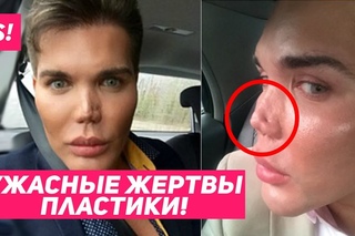 САМЫЕ ЖУТКИЕ ЖЕРТВЫ ПЛАСТИКИ / ЖИВЫЕ “КЕНЫ“ 😨😱