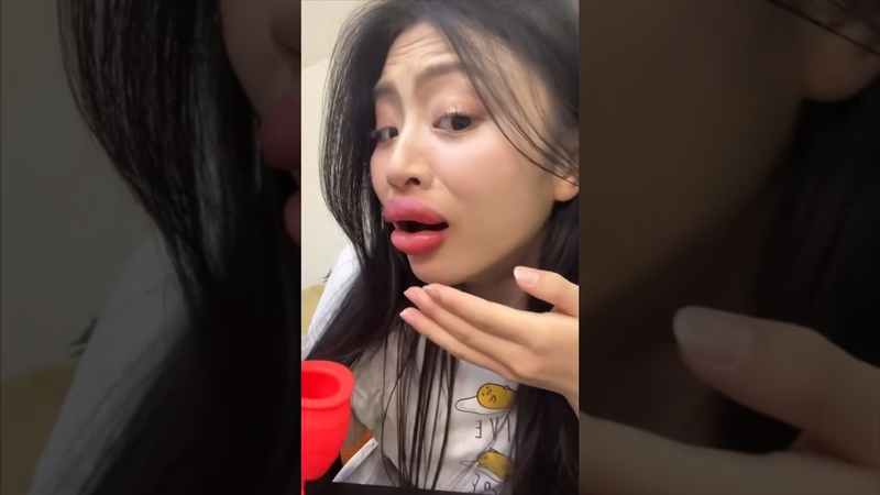 Preenchimento labial caseiro ( Resultado