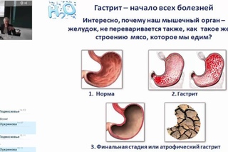 Лекция  Н. Г.  Байкуловой - Болезни обезвоживания.