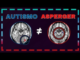 Diferenas entre Autismo e Sndrome de Asperger CREBRO, SINTOMAS E TRATAMENTOS