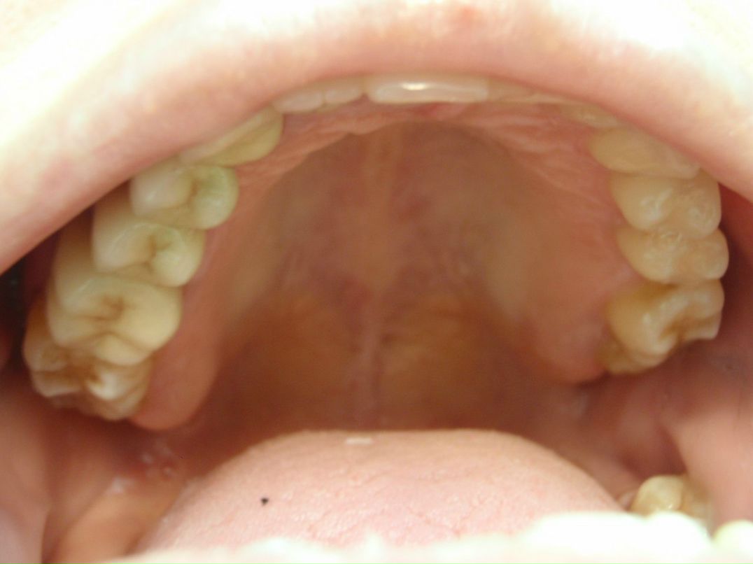 Эрнест Абрамян | Москва