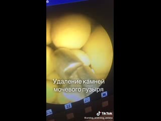 ауе#60