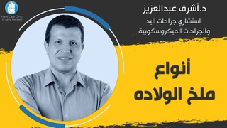 أسئلة كتير عن ما هي أنواع ملخ الولاده يجيب ع&#