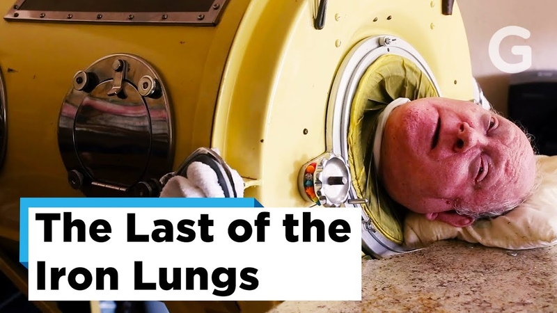 The Last Few Polio Survivors Last of the Iron Lungs,