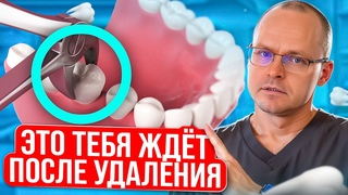 Как Убрать Высокую Чувствительность в зоне Удаления Зуба за 5 минут