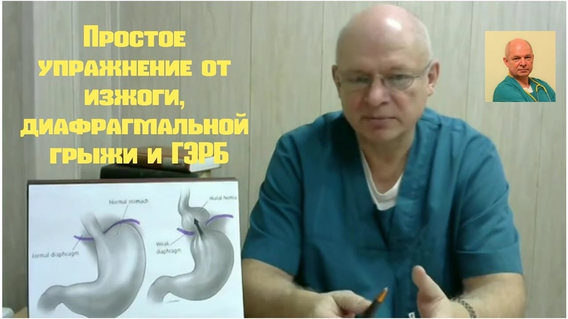 Простое упражнение от изжоги, диафрагмальной грыжи и